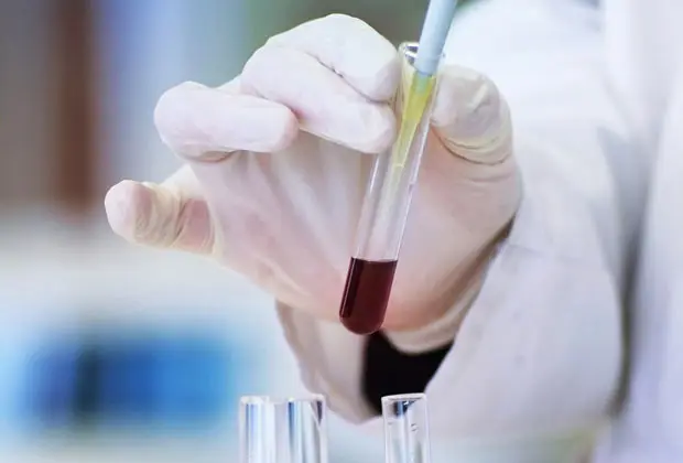 R B S College of Pharmacy: campus photo 2